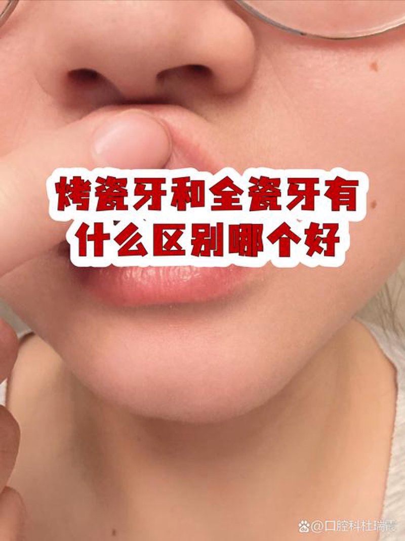 如何选择合适的洗牙洁牙服务