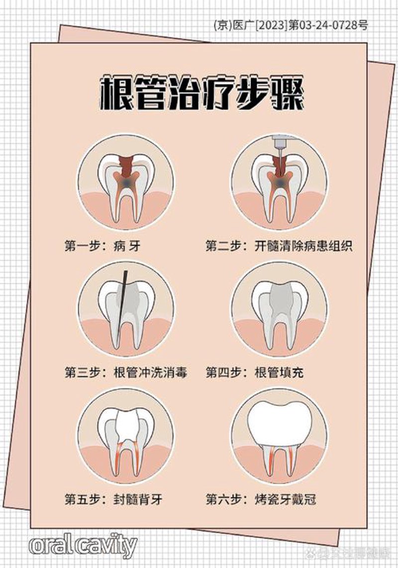 牙齿矫正：从矫正误区到美丽升级的艺术