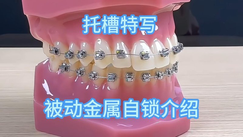 牙齿矫正